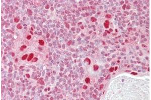 Anti-MSH5 antibody IHC staining of human thymus. (MSH5 Antikörper  (AA 508-519))