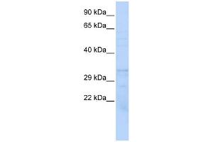 WB Suggested Anti-PSMB1 Antibody Titration: 0. (PSMB1 Antikörper  (Middle Region))