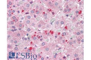 Immunohistochemistry (IHC) image for anti-SET Nuclear Oncogene (SET) (N-Term) antibody (ABIN184618)