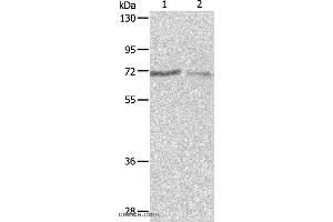 Western blot analysis of A375 and A431 cell, using PTPN6 Polyclonal Antibody at dilution of 1:500 (SHP1 Antikörper)