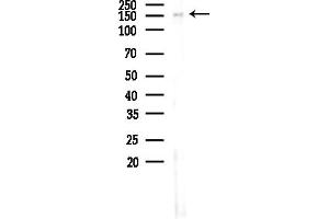 anti-Splicing Factor 3b, Subunit 1, 155kDa (SF3B1) (N-Term) antibody
