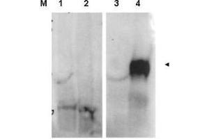 Image no. 1 for anti-Fibroblast Activation Protein, alpha (FAP) (Internal Region) antibody (ABIN1101478) (FAP Antikörper  (Internal Region))