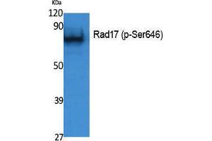 Western Blotting (WB) image for anti-RAD17 (RAD17) (pSer646) antibody (ABIN3183071) (RAD17 Antikörper  (pSer646))
