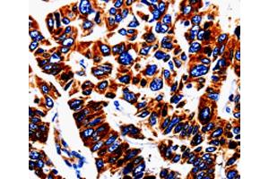 Immunohistochemistry (IHC) image for anti-Urotensin 2 (UTS2) antibody (ABIN5543194) (Urotensin 2 Antikörper)