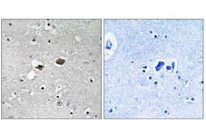 Immunohistochemistry analysis of paraffin-embedded human brain tissue, using TIGD3 antibody. (TIGD3 Antikörper  (C-Term))