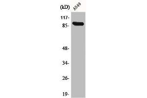 Western Blot analysis of A549 cells using Cadherin-16 Polyclonal Antibody (Cadherin-16 Antikörper  (C-Term))