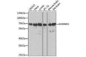 Western blot analysis of extracts of various cell lines, using KHDRBS1 antibody. (KHDRBS1 Antikörper  (C-Term))