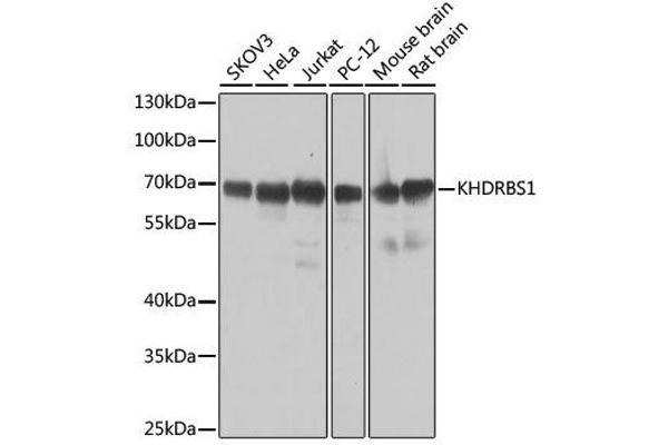 KHDRBS1 antibody  (C-Term)