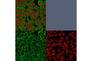 Confocal immunofluorescence image of HeLa cells using Fascin-1 Mouse Monoclonal Antibody (FSCN1/416). (Fascin Antikörper)
