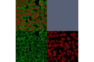 Confocal immunofluorescence image of HeLa cells using Fascin-1 Mouse Monoclonal Antibody (FSCN1/416). (Fascin Antikörper)