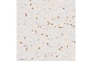 Immunohistochemistry (Paraffin-embedded Sections) (IHC (p)) image for anti-Hepatoma-Derived Growth Factor-Related Protein 3 (HDGFRP3) antibody (ABIN7074198)