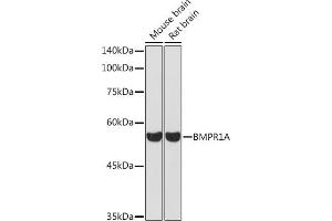 Western blot analysis of extracts of various cell lines, using BMPR1A Rabbit pAb (ABIN3022599, ABIN3022600, ABIN3022601 and ABIN6218934) at 1:1000 dilution. (BMPR1A Antikörper  (AA 24-200))