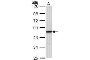WB Image Sample (30 ug of whole cell lysate) A: 293T 10% SDS PAGE antibody diluted at 1:1000 (MEK1 Antikörper)