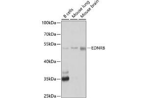Western blot analysis of extracts of various cell lines, using EDNRB antibody (ABIN3016961, ABIN3016962, ABIN1679650 and ABIN6219903) at 1:1000 dilution. (EDNRB Antikörper  (AA 1-100))