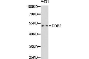 Western blot analysis of extracts of A-431 cells, using DDB2 antibody (ABIN5970947) at 1/1000 dilution. (DDB2 Antikörper)