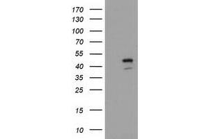 Image no. 1 for anti-serpin Peptidase Inhibitor, Clade B (Ovalbumin), Member 4 (SERPINB4) antibody (ABIN1500891) (SERPINB4 Antikörper)