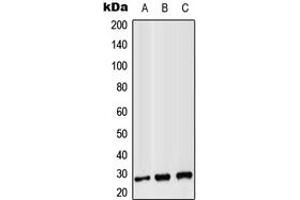 Western blot analysis of CD8b expression in Jurkat (A), Raw264. (CD8B Antikörper  (Center))