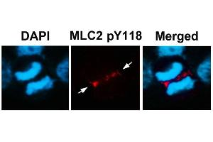 Immunofluorescence staining of methanol-fixed U87 cells using MLC2 (Phospho-Tyr118) Antibody.