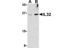Western blot analysis of IL-32 in Jurkat cell lysate with AP30425PU-N IL-32 antibody at (A) 2. (IL32 Antikörper  (Intermediate Domain))