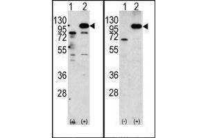 (LEFT)Western blot analysis of APP (arrow) using rabbit polyclonal APP Antibody (N-term). (APP Antikörper  (C-Term))
