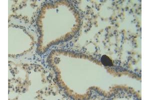 DAB staining on IHC-P; Samples: Mouse Lung Tissue (ANG Antikörper  (AA 25-145))