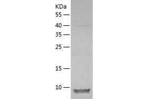 Western Blotting (WB) image for Dynein (AA 1-89) protein (His tag) (ABIN7122719) (Dynein Protein (AA 1-89) (His tag))
