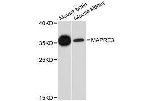 Western blot analysis of extracts of various cell lines, using MAPRE3 antibody. (MAPRE3 Antikörper)
