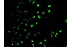 Immunofluorescence analysis of U2OS cells using E2F6 antibody. (E2F6 Antikörper)