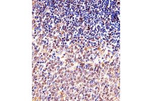 Immunohistochemical analysis of paraffin-embedded M. (Cyclin B1 Antikörper  (AA 103-130))