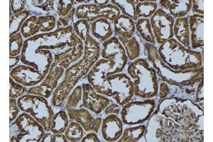 ABIN6278976 at 1/100 staining Rat kidney tissue by IHC-P. (ACAA2 Antikörper  (Internal Region))