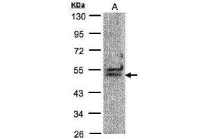 WB Image Sample(30 μg of whole cell lysate) A:Hep G2, 10% SDS PAGE antibody diluted at 1:1000 (DDX39B Antikörper)