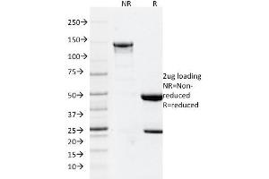 SDS-PAGE Analysis Purified GFAP Mouse Monoclonal Antibody (GFAP/2076). (GFAP Antikörper  (AA 101-200))