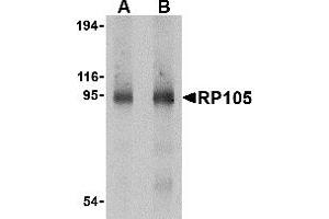 Western Blotting (WB) image for anti-CD180 Molecule (CD180) (C-Term) antibody (ABIN1030626) (CD180 Antikörper  (C-Term))