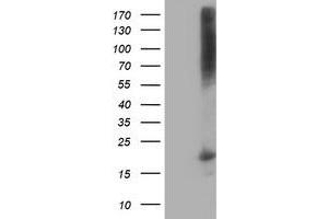 Western Blotting (WB) image for anti-Destrin (Actin Depolymerizing Factor) (DSTN) antibody (ABIN1497911)