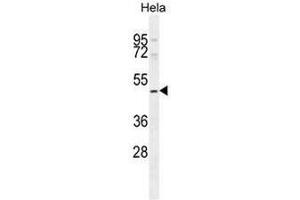 SMYD1 Antibody (C-term) western blot analysis in Hela cell line lysates (35µg/lane).