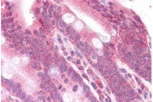 Human Small Intestine: Formalin-Fixed, Paraffin-Embedded (FFPE) (MEK2 Antikörper  (N-Term))