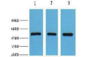 Western Blotting (WB) image for anti-Fumarate Hydratase (FH) antibody (ABIN3181264) (FH Antikörper)