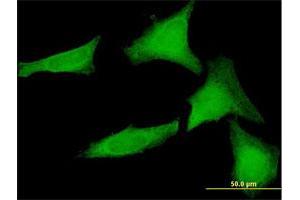 Immunofluorescence (IF) image for anti-Small Glutamine-Rich Tetratricopeptide Repeat (TPR)-Containing, alpha (SGTA) (AA 1-313) antibody (ABIN520163)