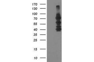 Western Blotting (WB) image for anti-Katanin P80 (WD Repeat Containing) Subunit B 1 (KATNB1) antibody (ABIN1498991) (KATNB1 Antikörper)