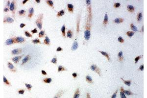 Anti-Prohibitin antibody, ICC ICC: HELA Cell (Prohibitin Antikörper  (C-Term))