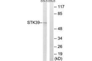 Western blot analysis of extracts from COLO205 cells, using STK39 Antibody. (STK39 Antikörper  (AA 351-400))