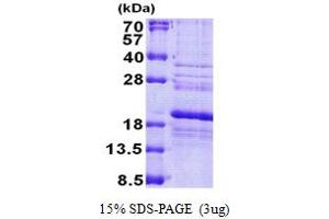 SDS-PAGE (SDS) image for Ribosomal Protein S24 (RPS24) (AA 1-130) protein (His tag) (ABIN5778897)