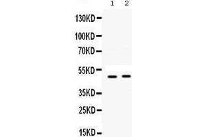 Western blot analysis of SFRP4 expression in A549 whole cell lysates (lane 1) and SW620 whole cell lysates (lane 2). (SFRP4 Antikörper  (AA 22-303))