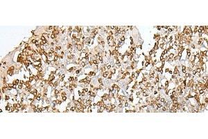 Immunohistochemistry of paraffin-embedded Human tonsil tissue using SEPT1 Polyclonal Antibody at dilution of 1:50(x200) (Septin 1 Antikörper)