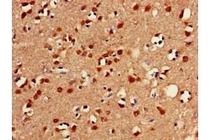 Immunohistochemistry of paraffin-embedded human brain tissue using ABIN7153026 at dilution of 1:100 (FOXC2 Antikörper  (AA 24-294))