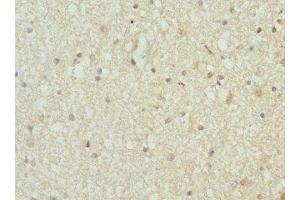Immunohistochemistry (IHC) image for anti-threonyl-tRNA Synthetase (TARS) (AA 1-230) antibody (ABIN7172077)