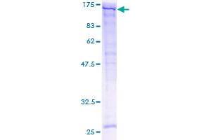 Image no. 1 for SPARC-Like 1 (Hevin) (SPARCL1) (AA 18-664) protein (GST tag) (ABIN1321086) (SPARCL1 Protein (AA 18-664) (GST tag))