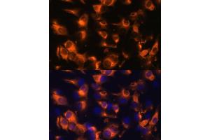 Immunofluorescence analysis of C6 cells using Somatostatin Receptor 2 (SSTR2) Polyclonal Antibody (ABIN7270493) at dilution of 1:100 (40x lens). (SSTR2 Antikörper  (C-Term))