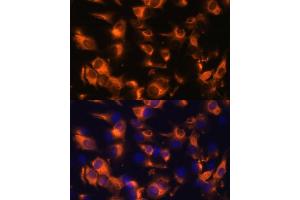 Immunofluorescence analysis of C6 cells using Somatostatin Receptor 2 (SSTR2) Polyclonal Antibody (ABIN7270493) at dilution of 1:100 (40x lens). (SSTR2 Antikörper  (C-Term))