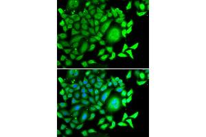 Immunofluorescence analysis of MCF7 cell using CD47 antibody. (CD47 Antikörper)